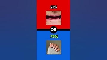 Would You Rather? Part 27