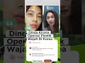 Dinda Kirana Operasi Plastik