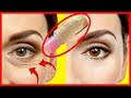 Put This Milky Oil Under Your Eyes, Remove Wrinkles and Dark Circles