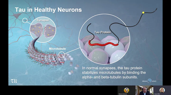 Targeting Tau in Alzheimer's Disease