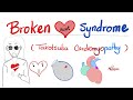 Broken Heart 💔 Syndrome (Takotsubo cardiomyopathy) | Cardiology Series