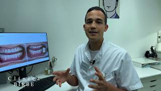 Caso Clínico Odontologia | Clínica Birbe