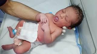 Birth Asphyxia Baby Nicu Care Management, Recovery & Starting Feeding Trial Good Condition