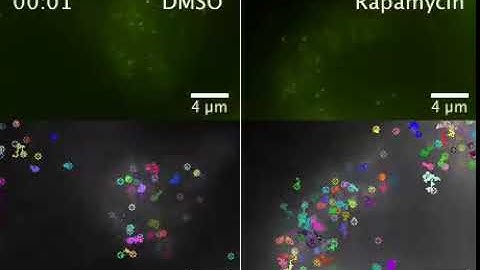 Cytoplasmic Crowding