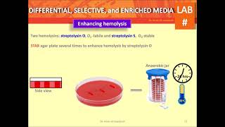 Types of culture media: differential, selective and enriched