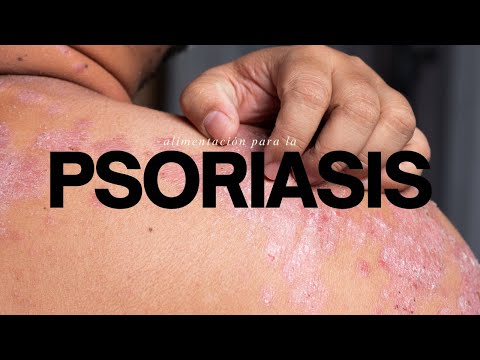 Psoriasis y nutrición: guía completa para controlar los brotes con la comida