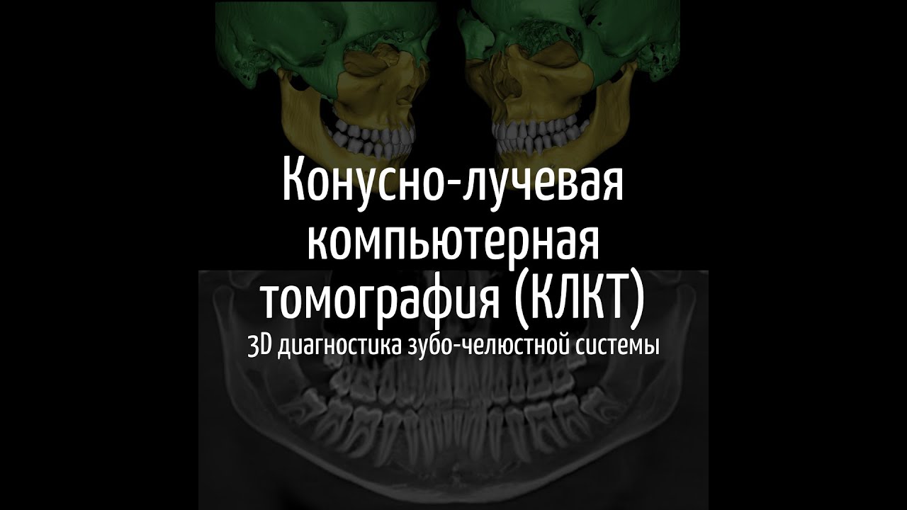 Конусно-лучевая компьютерная томография КЛКТ 3D диагностика