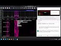 Media Broadcast – Music 4 Joy 17670kHz DRM (xHE-AAC Stereo), Pop Music, ID: 10