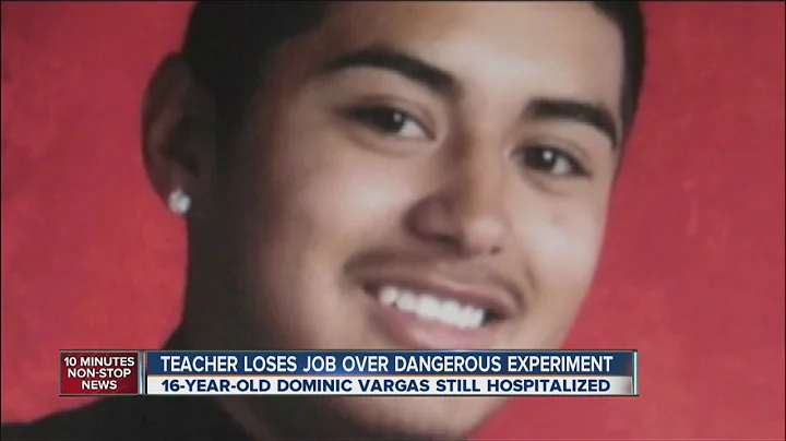 Teacher fired after teens injured when science experiment explodess