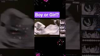 Baby's gender at 12 weeks ultrasound. Boy or girl? جنس الجنين في الأسبوع الثاني عشر. ولد أم بنت؟