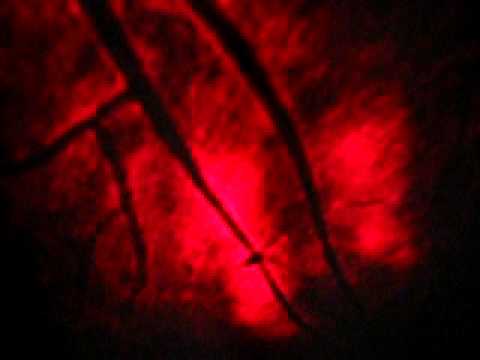 Interference fringes