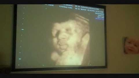 Goldenview Ultrasound .mp4