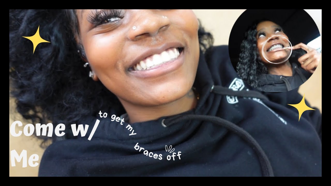 Come W/ Me To Remove My Braces After 6 Years😁!