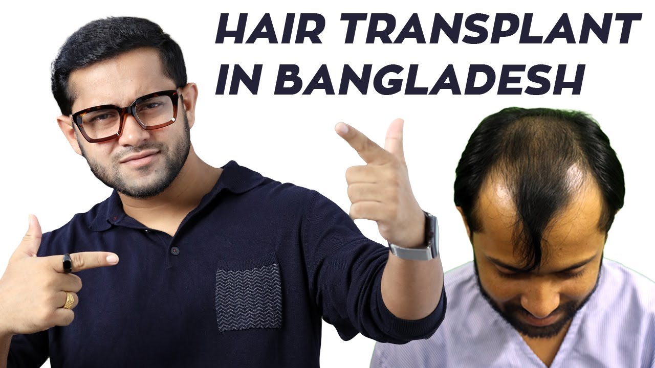 Hair Transplant Bangladesh Hair Transplant Before & After Sapphire