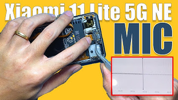 Xiaomi Mic Not Working? Here