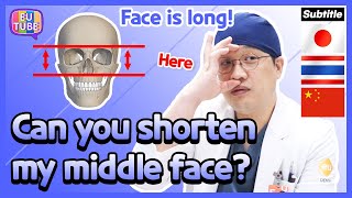 [EN/JP/TH/CH SUB] Face is long! Can you shorten my middle face through jaw surgery?