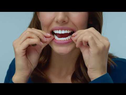 Reveal® Aligners - Switching to a New Set of Reveal Aligners