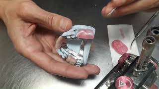 Posterior teeth set-up in S.P.D. technology