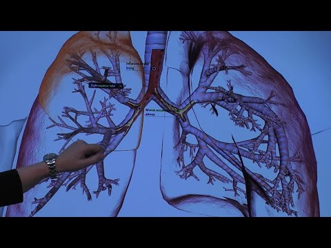 Video: Causes of pneumonia