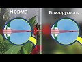 Грізні ускладнення короткозорості. Як вберегти зір херсонцям?