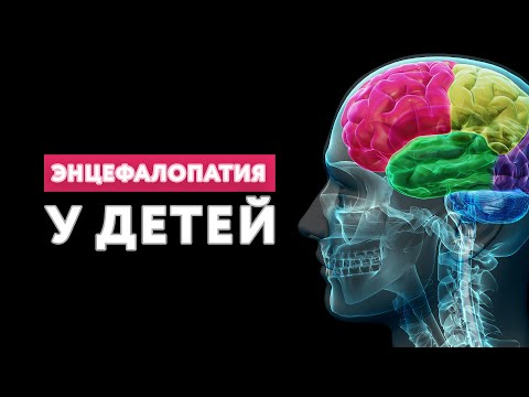 Энцефалопатия у детей // #нейроспектр #энцефалопатия