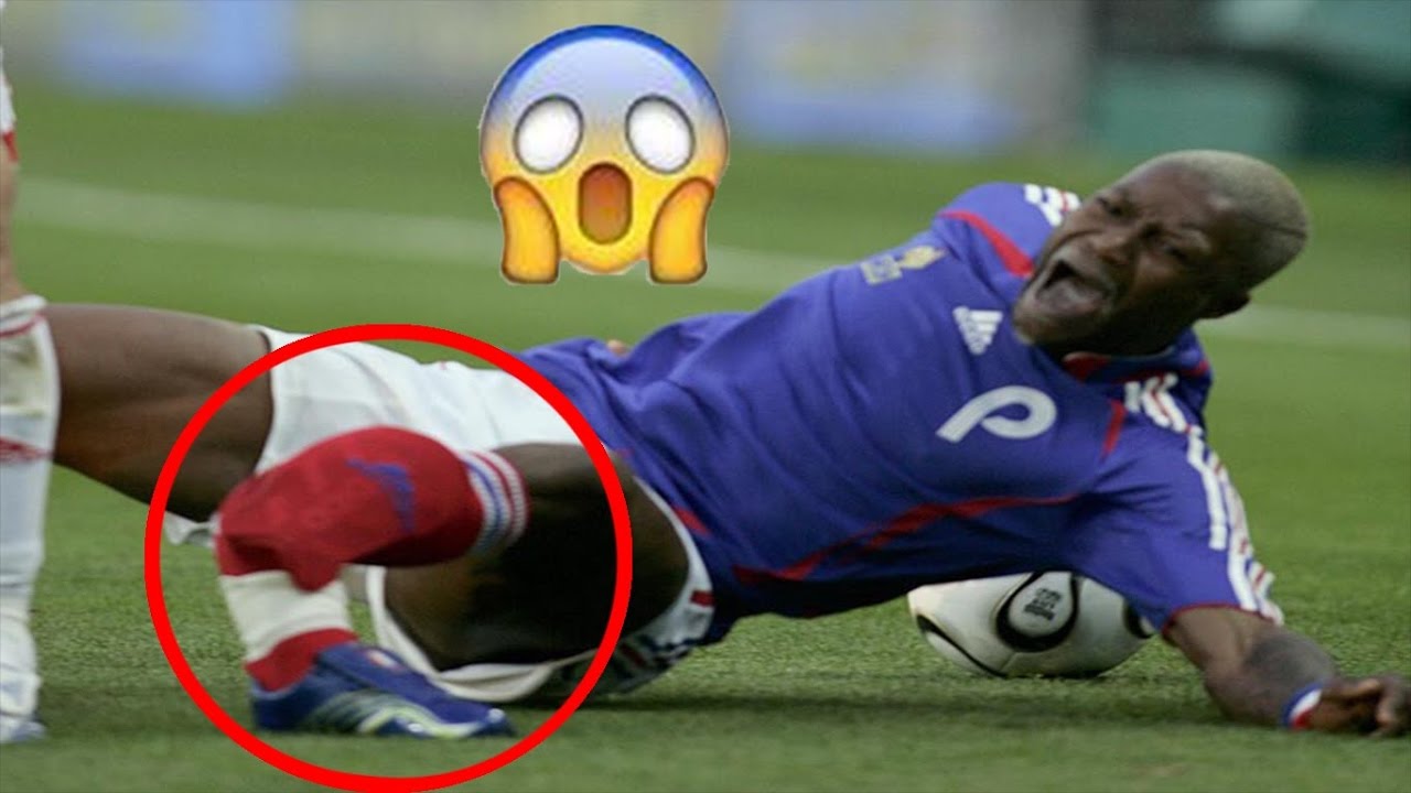 Omg Most Gruesome Scary Career Ending Football Injuries Must Watch