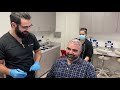 Hair Transplant Surgery in Los Angeles, CA. Best FUE Hair Restoration in LA, Beverly Hills, SF