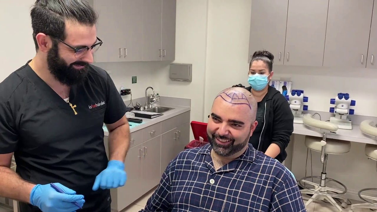 Hair Transplant Surgery in Los Angeles, CA. Best FUE Hair Restoration ...