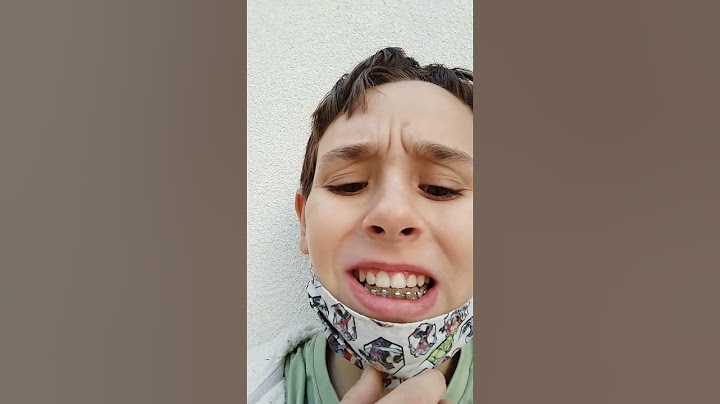 on m'a enlevé les bagues du haut