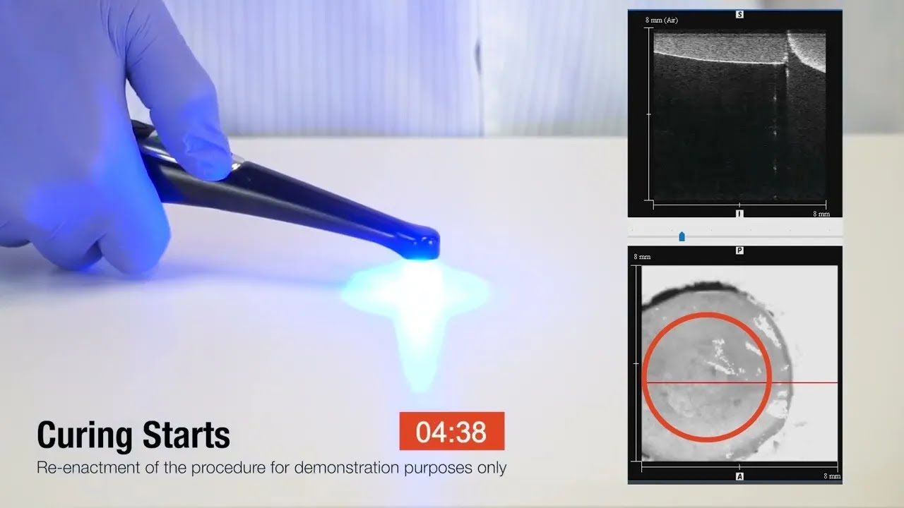 The Monet Curing Light: 1-Second Dental Curing