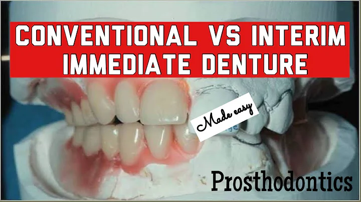 INTERIM VS CONVENTIONAL IMMEDIATE DENTURE II DIFFERENCES I IMMEDIATE DENTURE II PROSTHODONTICS I imp