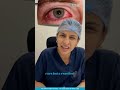 Is changing your eye color medically advised - Dr. Alisha