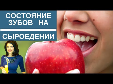 Состояние моих ЗУБОВ
