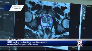 MRI technology used to detect and screen for prostate cancer