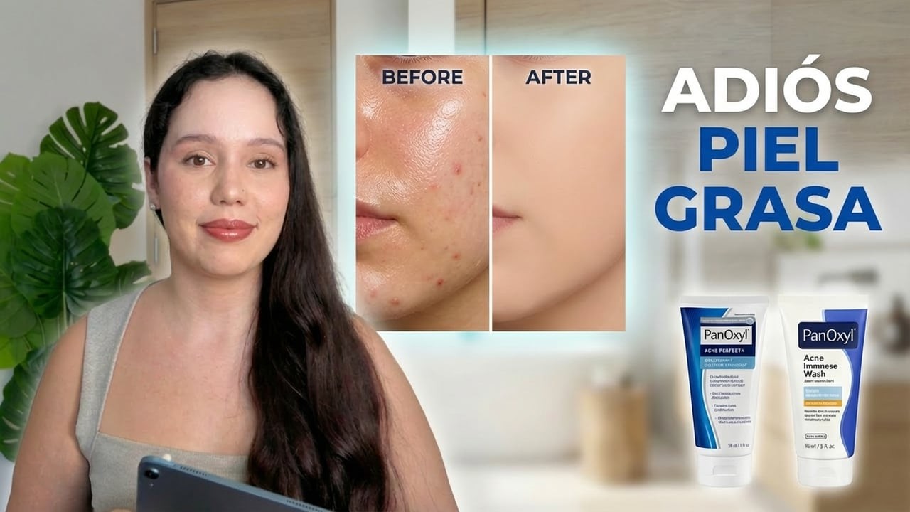 Piel Grasa: Por Qué Te Salen Brotes + Rutina Completa Desde 0