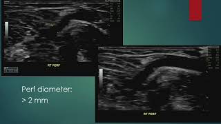 VIC   2022 Ultrasound Conference   Session #6