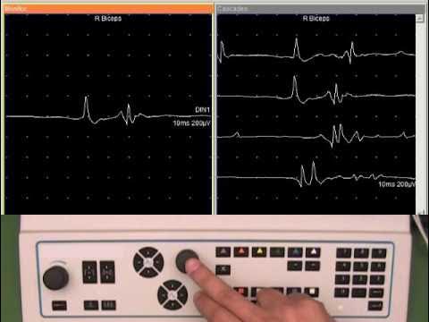 Sistema de neurodiagnóstico UltraPro® S100 - Natus