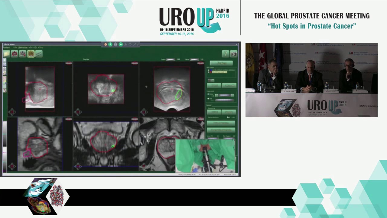 06 - URO UP 2016: Sesión Quirúrgica I camera iphone 8 plus apk