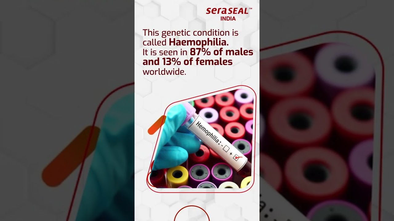 Haemophilia Treatment with SeraSeal™️ | Stops bleeding within seconds