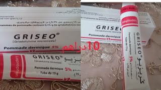 بغيتي فروة شعرك تقوى وشعرك يهنيك من التساقط مرهم Griseo حتى لفطريات الاضافر ولكزيما ب 10دراهم