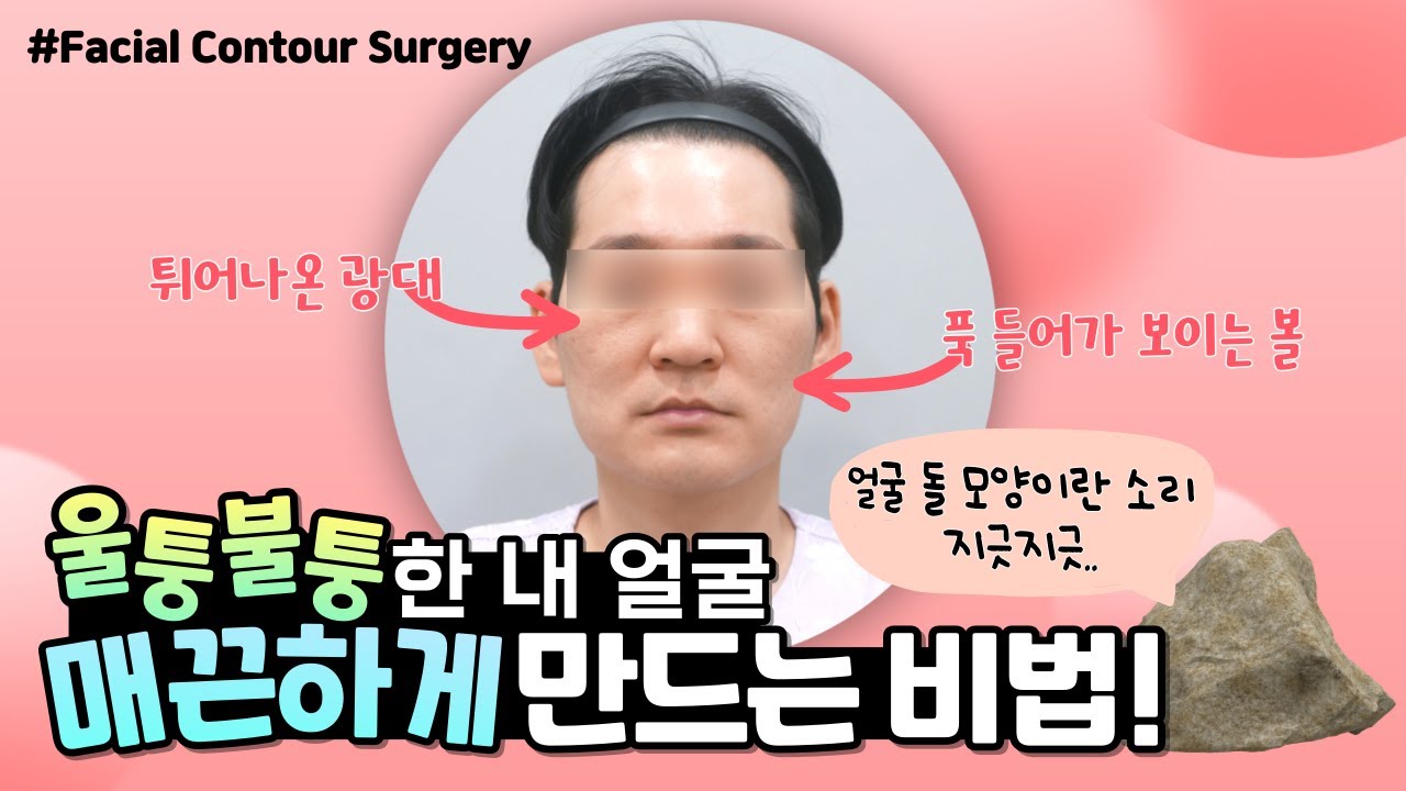 [Thẩm mỹ viện Jayjun] Bạn tự ti về khuôn mặt của mình? Biến hóa với phẫu thuật đường nét và cấy mỡ để có khuôn mặt mịn màng như quả trứng~❗