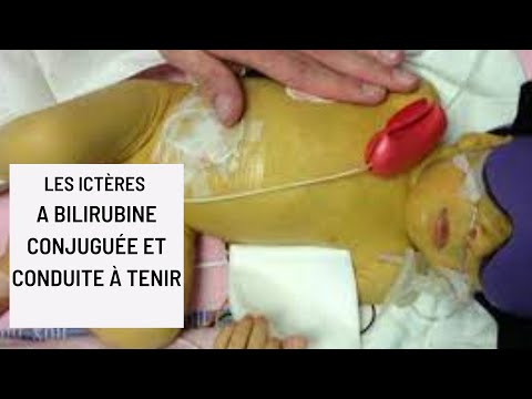 Vidéo: Bilirubine élevée - Causes Et Symptômes De La Bilirubine, Diagnostic, Traitement Et Prévention