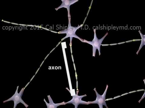 Traumatic Brain Injury - Diffuse Axonal Injury (DAI)  - Animation by Dr. Cal Shipley, M.D.