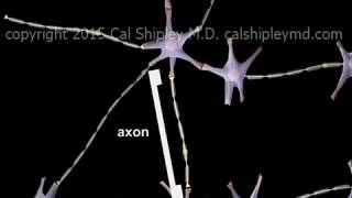 Traumatic Brain Injury - Diffuse Axonal Injury (DAI)  - Animation by Dr. Cal Shipley, M.D.