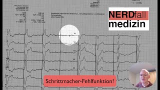 EKG-Quickie: Schrittmacher!