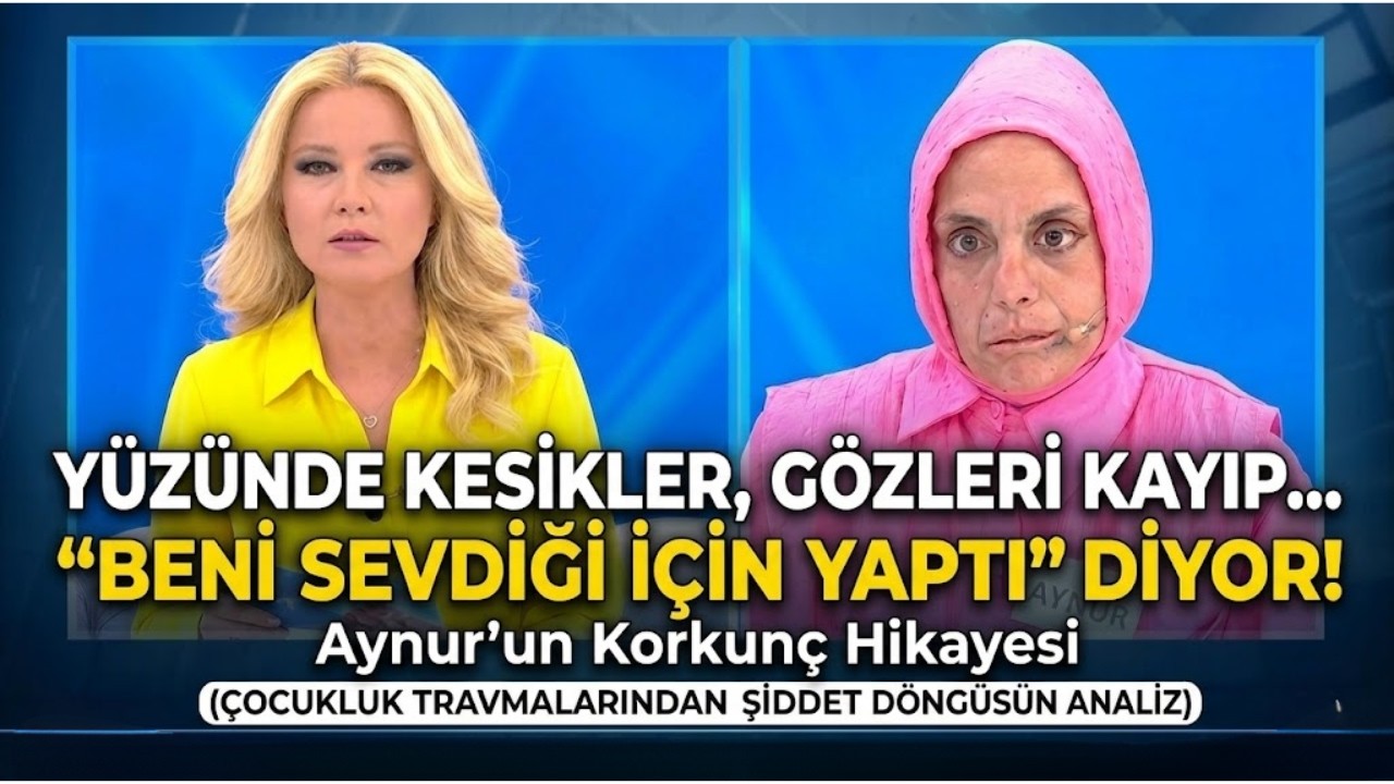 Gözünü Kaybetti Ama Hala 