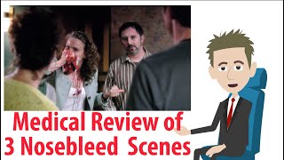 ENT Reviews 3 Severe Nosebleed Scenes from TV Shows