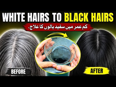 Premature grey hair cause || white hair to black hair naturally @ zonni lifestyle
