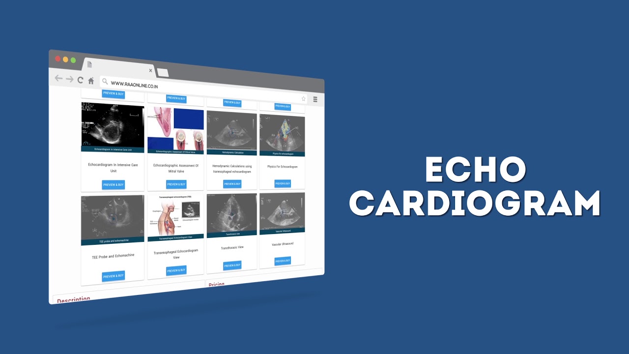 Echocardiogram