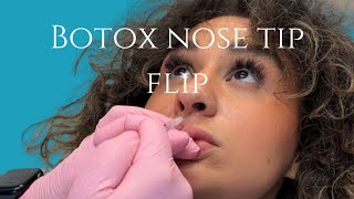 Nose Slimming and Tip Lift with Botox by Dr Arthur in Miami #nosebotox #slimnose